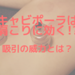 キャビポーラは肩こりに効く？吸引の威力とは？