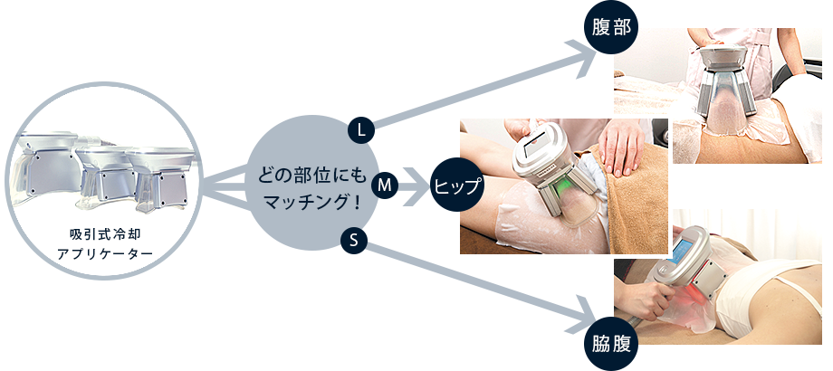 脂肪冷却機器【クライオミュー(Cryo-μ)】は効果ある？