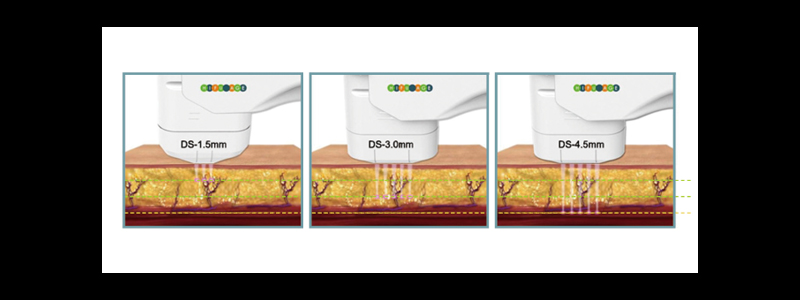ハイブリットフォーカス