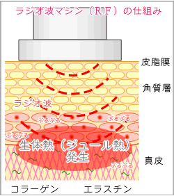 美容機器ハイパーマジックラインとは？スペック・機能を紹介！