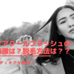 エアクールフラッシュの特徴は？脱毛方法は？