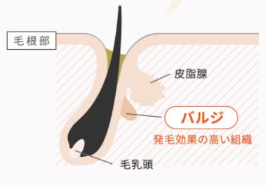 ハイブリット抑毛