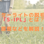 マスターライトの脱毛方式「S-IPL」とは？原理などを解説！